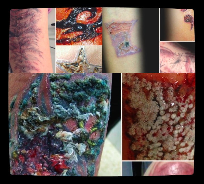bloodborne pathogens infected tattoo